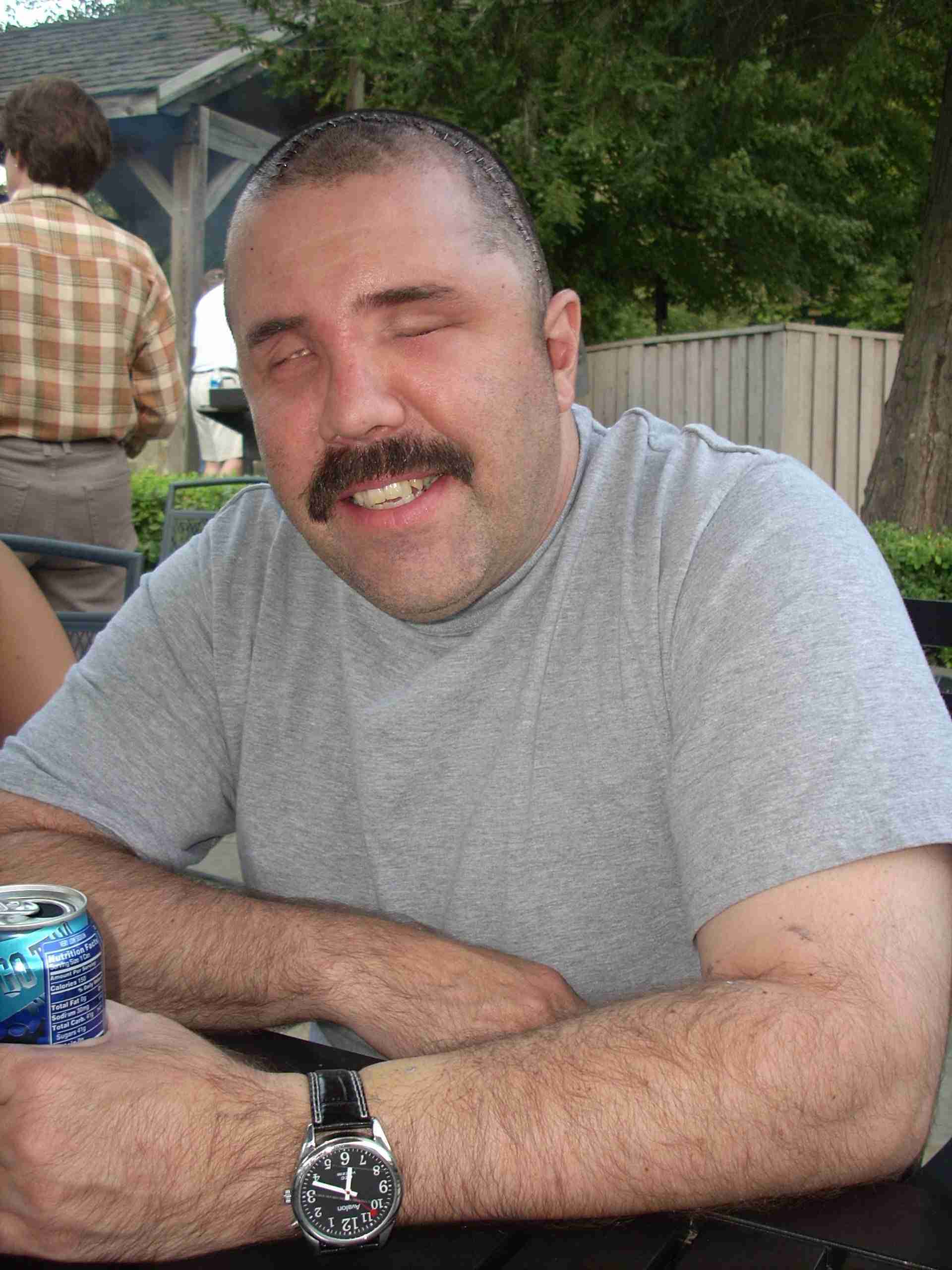 Aaron after titanium.jpg